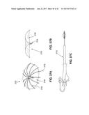 SYSTEM FOR IMPROVING CARDIAC FUNCTION BY SEALING A PARTITIONING MEMBRANE     WITHIN A VENTRICLE diagram and image