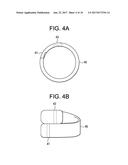 Expandable Ring Intervertebral Fusion Device diagram and image