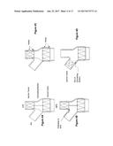 PULMONARY ARTERY IMPLANT APPARATUS AND METHODS OF USE THEREOF diagram and image