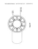 PULMONARY ARTERY IMPLANT APPARATUS AND METHODS OF USE THEREOF diagram and image