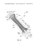 STENTS AND STENT DEPLOYMENT DEVICES diagram and image