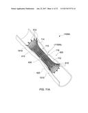 STENTS AND STENT DEPLOYMENT DEVICES diagram and image