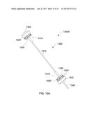 STENTS AND STENT DEPLOYMENT DEVICES diagram and image