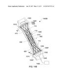 STENTS AND STENT DEPLOYMENT DEVICES diagram and image