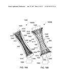 STENTS AND STENT DEPLOYMENT DEVICES diagram and image