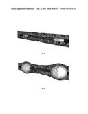 STENTS AND STENT DEPLOYMENT DEVICES diagram and image