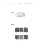 METHODS AND COMPOSITIONS FOR INDUCTION OF UCP1 EXPRESSION diagram and image