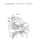 TREATMENT OF THE EAR diagram and image