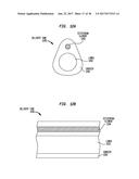 TREATMENT OF THE EAR diagram and image