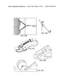 BALL REBOUNDING SYSTEM diagram and image