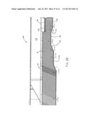 STEPPED WALL SINGULATOR CONVEYOR FOR OVERSIZED ITEM REMOVAL diagram and image