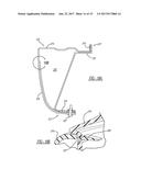 RESISTIVE IMPLANT WELDING CARBON FIBER THERMOPLASTICS USING HIGHLY     CONDUCTIVE MESH diagram and image