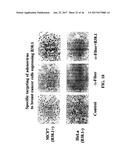 ISOLATION AND USE OF SOLID TUMOR STEM CELLS diagram and image