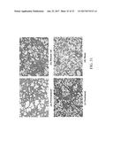 METHOD FOR TREATING FIBROSIS USING SIRNA AND A RETINOID-LIPID DRUG CARRIER diagram and image