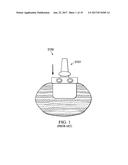 Quantitative In-Situ Texture Measurement Apparatus and Method diagram and image