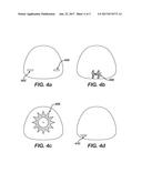 METHODS FOR INCORPORATING LENS FEATURES AND LENSES HAVING SUCH FEATURES diagram and image