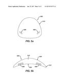 METHODS FOR INCORPORATING LENS FEATURES AND LENSES HAVING SUCH FEATURES diagram and image