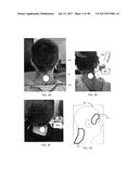 APPARATUSES AND METHODS FOR TRANSDERMAL ELECTRICAL STIMULATION OF NERVES     TO MODIFY OR INDUCE A COGNITIVE STATE diagram and image