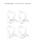 APPARATUSES AND METHODS FOR TRANSDERMAL ELECTRICAL STIMULATION OF NERVES     TO MODIFY OR INDUCE A COGNITIVE STATE diagram and image