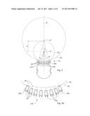 TOOTH-WHITENING DEVICE diagram and image