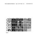 SYNTHESIS AND COMPOSITION OF AMINO ACID LINKING GROUPS CONJUGATED TO     COMPOUNDS USED FOR THE TARGETED IMAGING OF TUMORS diagram and image