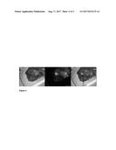 SYNTHESIS AND COMPOSITION OF AMINO ACID LINKING GROUPS CONJUGATED TO     COMPOUNDS USED FOR THE TARGETED IMAGING OF TUMORS diagram and image