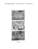 JOINING AND/OR SEALING TISSUES THROUGH PHOTO-ACTIVATED CROSS-LINKING OF     MATRIX PROTEINS diagram and image