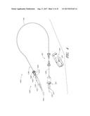 GUIDE FEATURES FOR PERCUTANEOUS CATHETER PUMP diagram and image