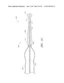 GUIDE FEATURES FOR PERCUTANEOUS CATHETER PUMP diagram and image