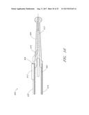 GUIDE FEATURES FOR PERCUTANEOUS CATHETER PUMP diagram and image