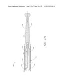 GUIDE FEATURES FOR PERCUTANEOUS CATHETER PUMP diagram and image