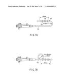 INSERTION APPARATUS diagram and image