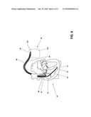 IMPLANTABLE MEDICAL DEVICE SYSTEM diagram and image