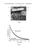 REAL-TIME IMAGING SYSTEM FOR MONITORING AND CONTROL OF THERMAL THERAPY     TREATMENTS diagram and image