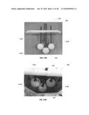 REAL-TIME IMAGING SYSTEM FOR MONITORING AND CONTROL OF THERMAL THERAPY     TREATMENTS diagram and image