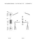 Tracking cardiac forces and arterial blood pressure using accelerometers diagram and image