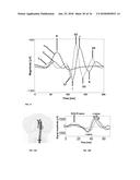 Tracking cardiac forces and arterial blood pressure using accelerometers diagram and image