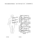 Tracking cardiac forces and arterial blood pressure using accelerometers diagram and image