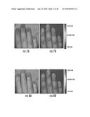 MULTI-SPECTRAL PHYSIOLOGIC VISUALIZATION (MSPV) USING LASER IMAGING     METHODS AND SYSTEMS FOR BLOOD FLOW AND PERFUSION IMAGING AND     QUANTIFICATION IN AN ENDOSCOPIC DESIGN diagram and image