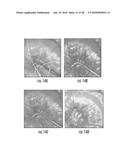 MULTI-SPECTRAL PHYSIOLOGIC VISUALIZATION (MSPV) USING LASER IMAGING     METHODS AND SYSTEMS FOR BLOOD FLOW AND PERFUSION IMAGING AND     QUANTIFICATION IN AN ENDOSCOPIC DESIGN diagram and image