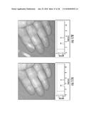 MULTI-SPECTRAL PHYSIOLOGIC VISUALIZATION (MSPV) USING LASER IMAGING     METHODS AND SYSTEMS FOR BLOOD FLOW AND PERFUSION IMAGING AND     QUANTIFICATION IN AN ENDOSCOPIC DESIGN diagram and image