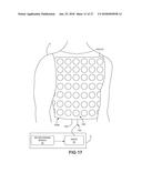 IDENTIFYING AMBIGUOUS CARDIAC SIGNALS FOR ELECTROPHYSIOLOGIC MAPPING diagram and image