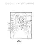 TWO ELECTRODE APPARATUS AND METHODS FOR TWELVE LEAD ECG diagram and image