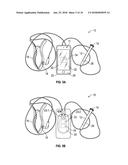 TWO ELECTRODE APPARATUS AND METHODS FOR TWELVE LEAD ECG diagram and image