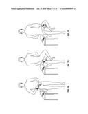 TWO ELECTRODE APPARATUS AND METHODS FOR TWELVE LEAD ECG diagram and image