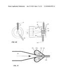 ELECTRO-DISCHARGE SYSTEM FOR NEUTRALIZING LANDMINES diagram and image