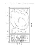 AUTOMATIC IMAGE CAPTURE BASED UPON INTRA-ORAL IMAGE ALIGNMENT diagram and image