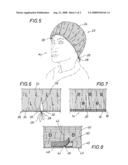 Surgical headpiece diagram and image