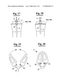 Remotely Actuated Robotic Wrist diagram and image