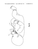 SUPPLEMENTAL AIR DIFFUSION DEVICES, KITS AND METHODS diagram and image